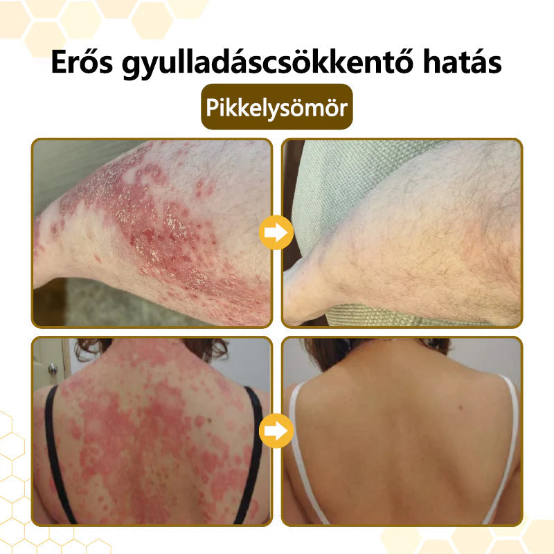 CleraNaure® PsoriaSoothe Méhméreg Bőrregeneráló Krém