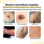 CleraNaure® PsoriaSoothe Méhméreg Bőrregeneráló Krém